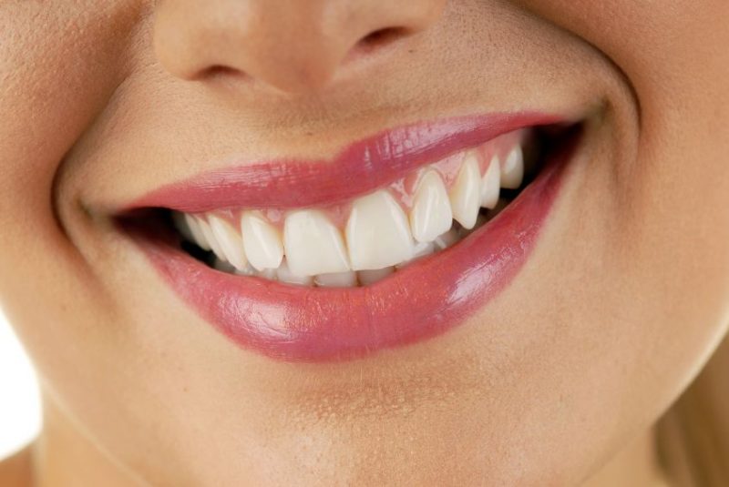 Where Should Somebody Go to Get Help with Invisalign in Evanston
