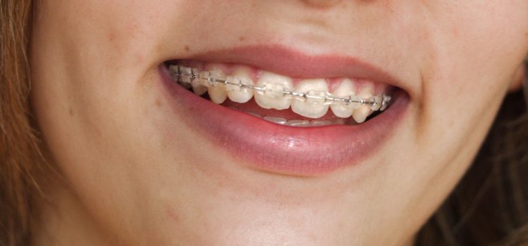 Make a New Year’s Resolution to Visit a Dentist in Spring, Texas