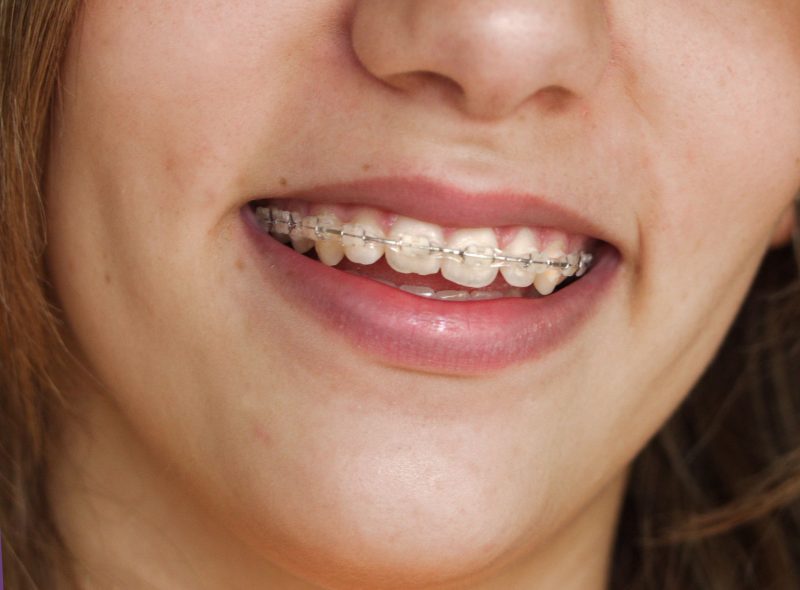 Make a New Year’s Resolution to Visit a Dentist in Spring, Texas