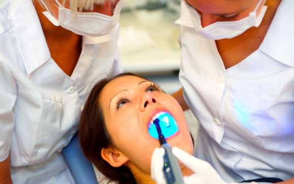 Benefits of Chairside Veneers in O’Fallon, MO