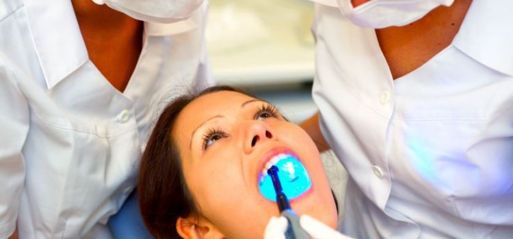 Benefits of Chairside Veneers in O’Fallon, MO