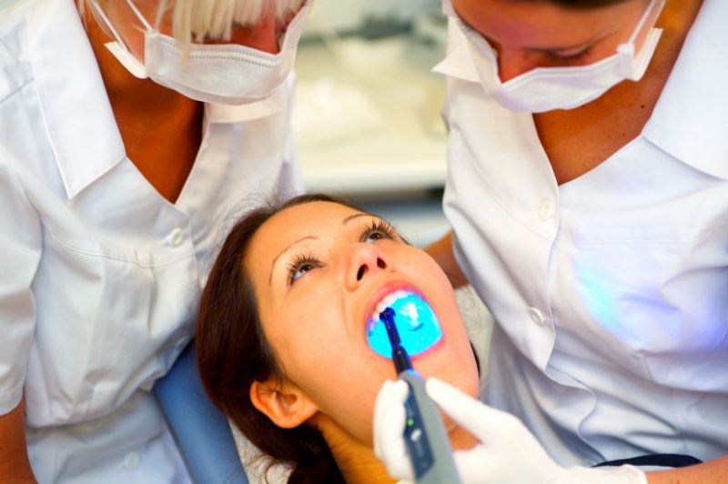 Benefits of Chairside Veneers in O’Fallon, MO