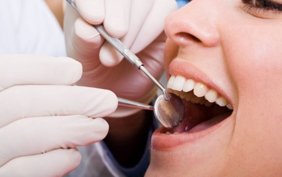 3 Advantages of Teeth Cleaning by a Dentist in Lincoln Square