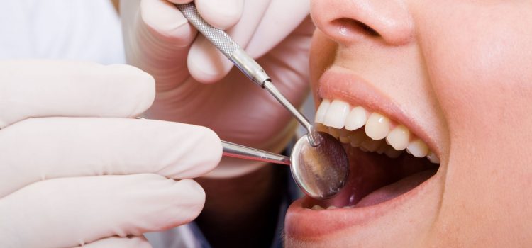 What to Expect After Getting a Tooth Filling in Del City, OK