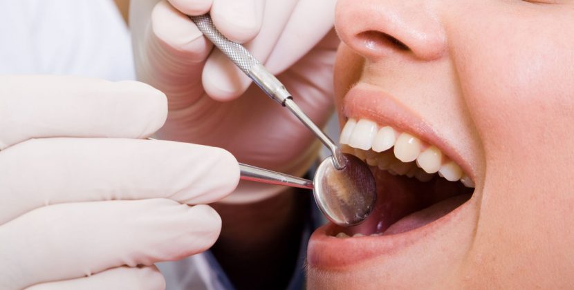 3 Advantages of Teeth Cleaning by a Dentist in Lincoln Square