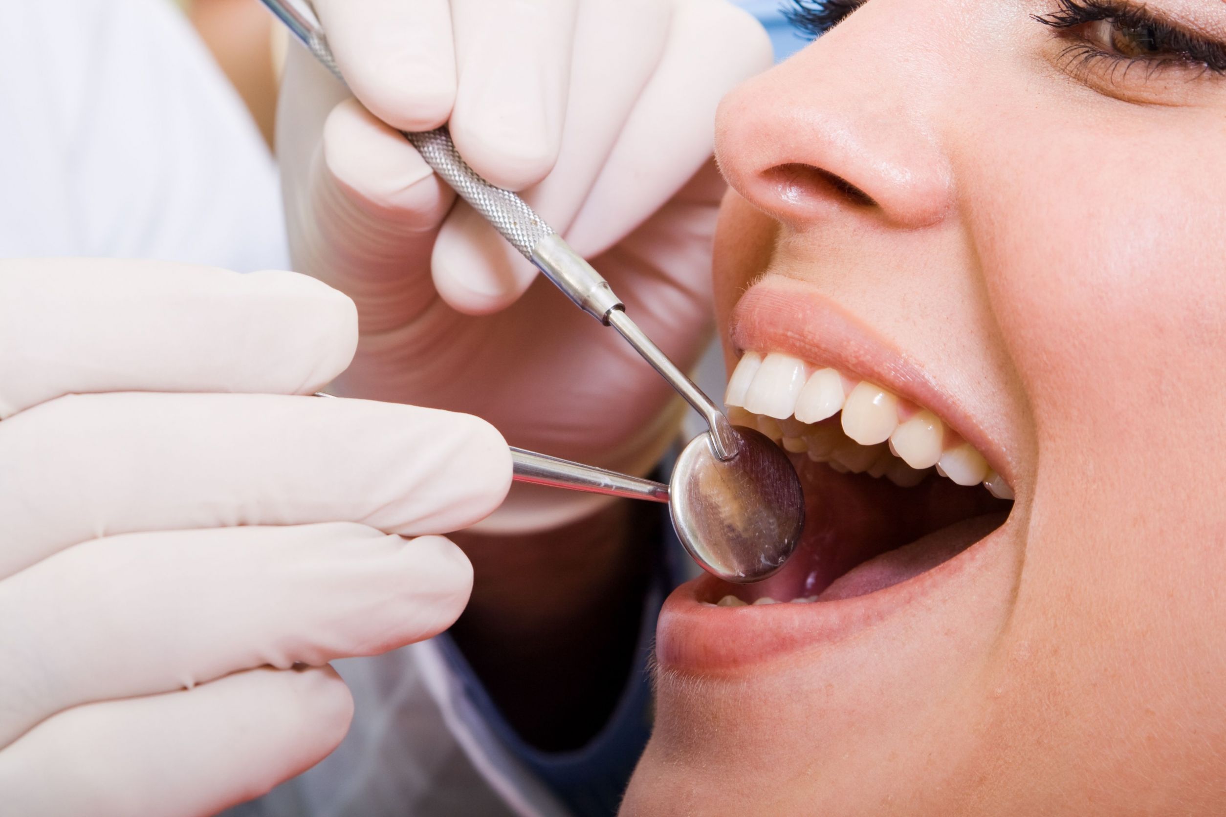 3 Advantages of Teeth Cleaning by a Dentist in Lincoln Square