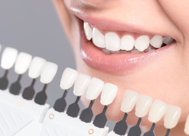 3 Reasons To Get Teeth Whitening Service From An Illinois Dental Practice