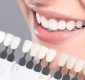 3 Reasons To Get Teeth Whitening Service From An Illinois Dental Practice