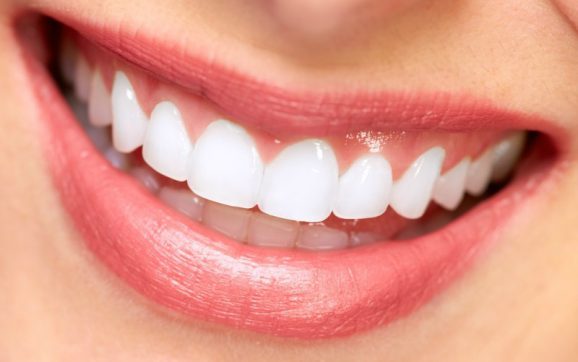 The Significance of a Family Dentist to Residents in Charlotte, NC