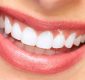 The Significance of a Family Dentist to Residents in Charlotte, NC